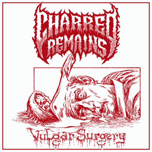 Charred Remains : Vulgar Surgery